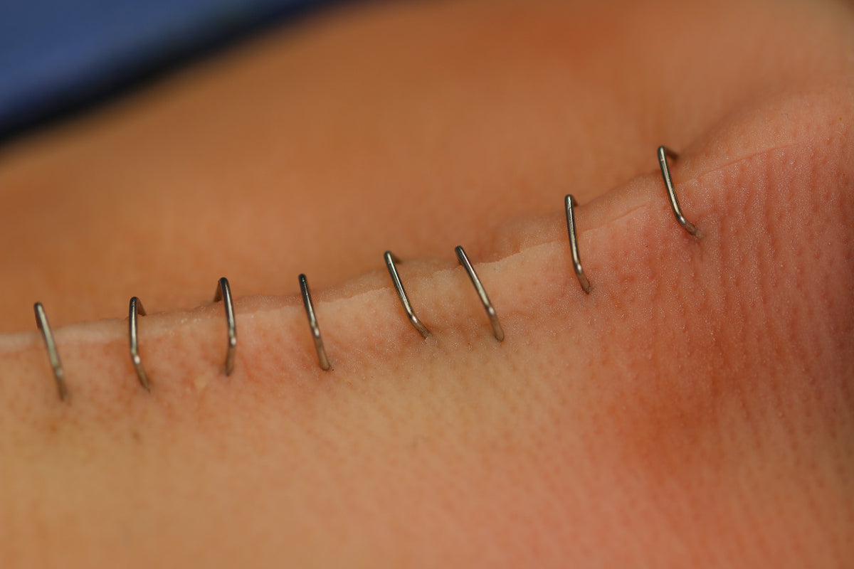 Staples in place