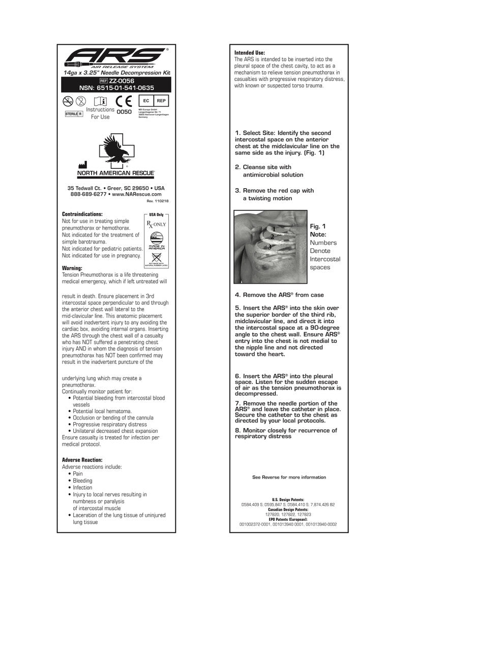 Needle decompression instructions.