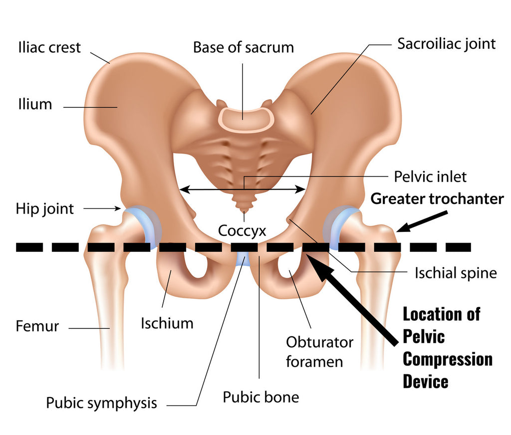 Sam Pelvic Sling II positioning