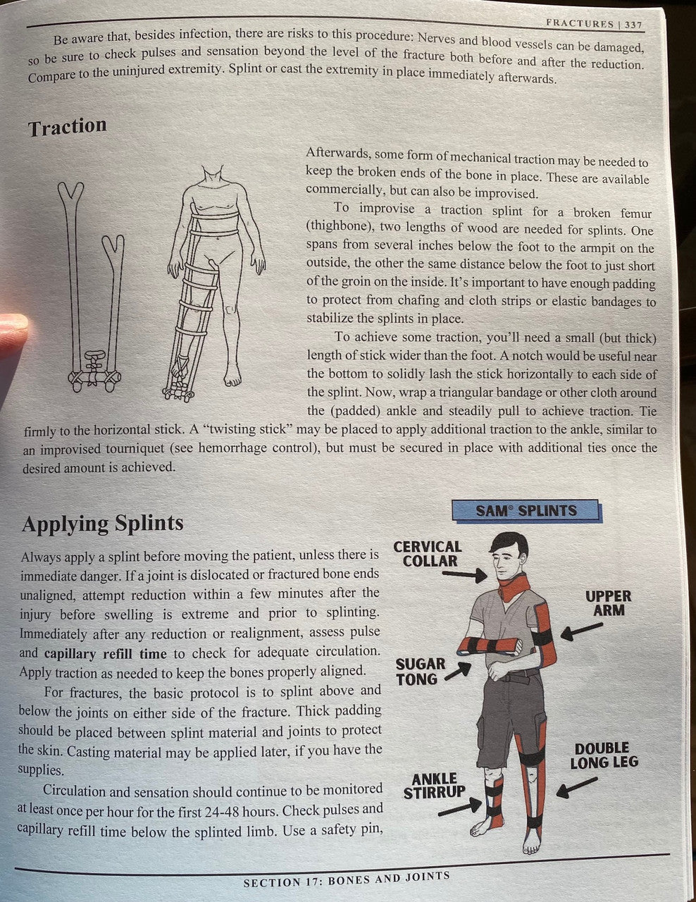 The Survival Medicine Handbook color version image, Sam Splints