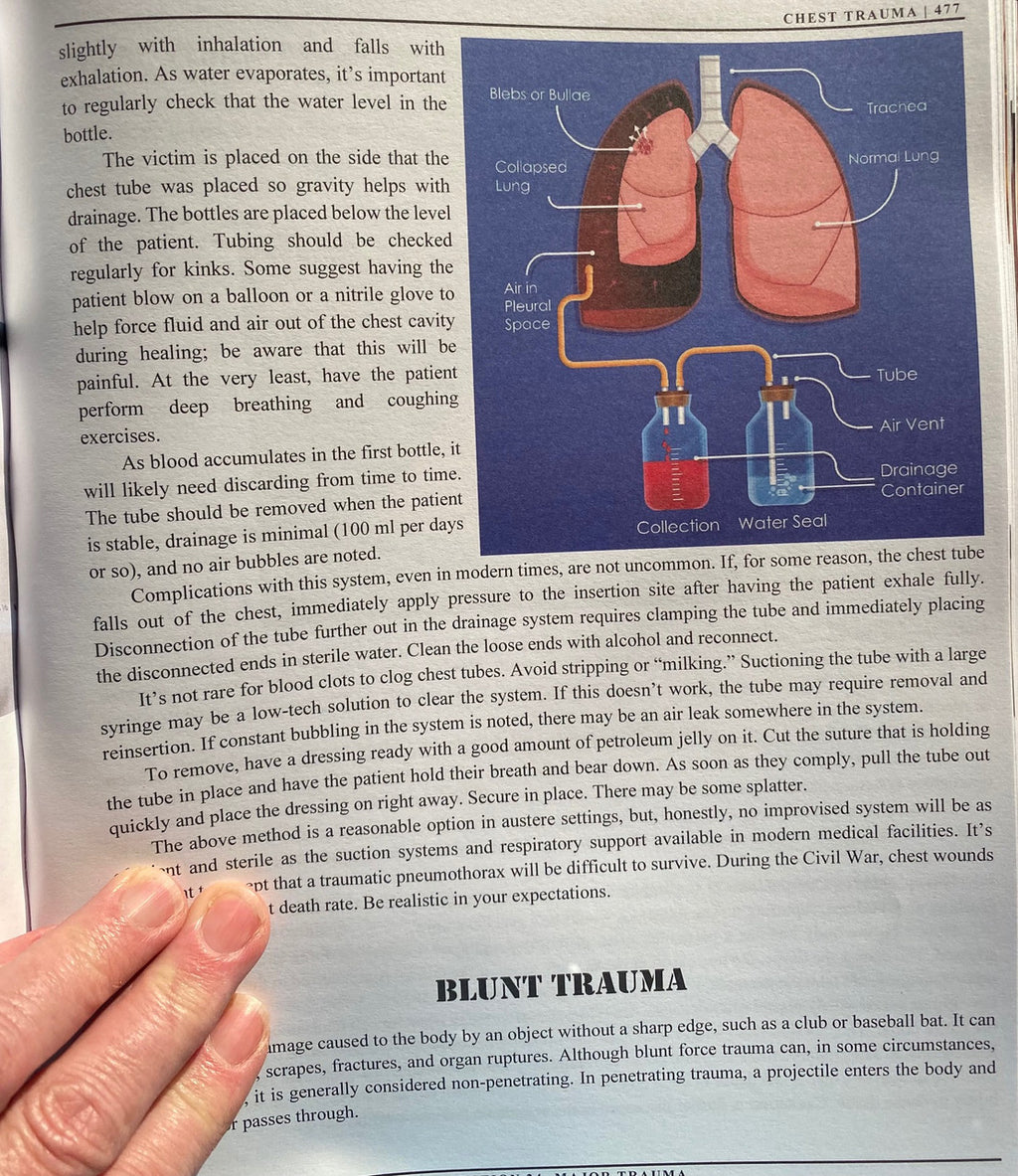 The Survival Medicine Handbook color version image, Chest tube drainage