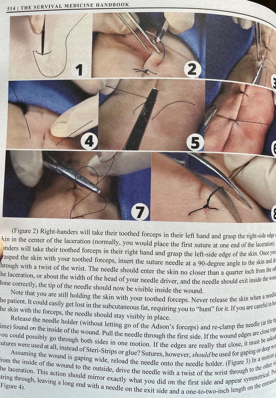 The Survival Medicine Handbook color version image, How to Suture