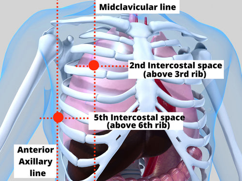 Location for needle decompression insertion