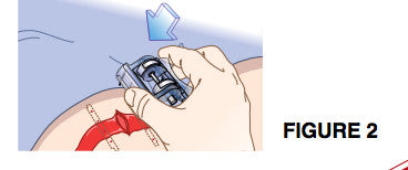 Placing an iTClamp