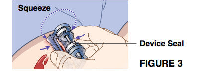Placing an iTClamp