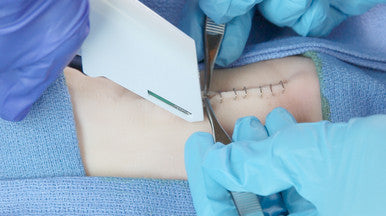 SKIN STAPLER KIT